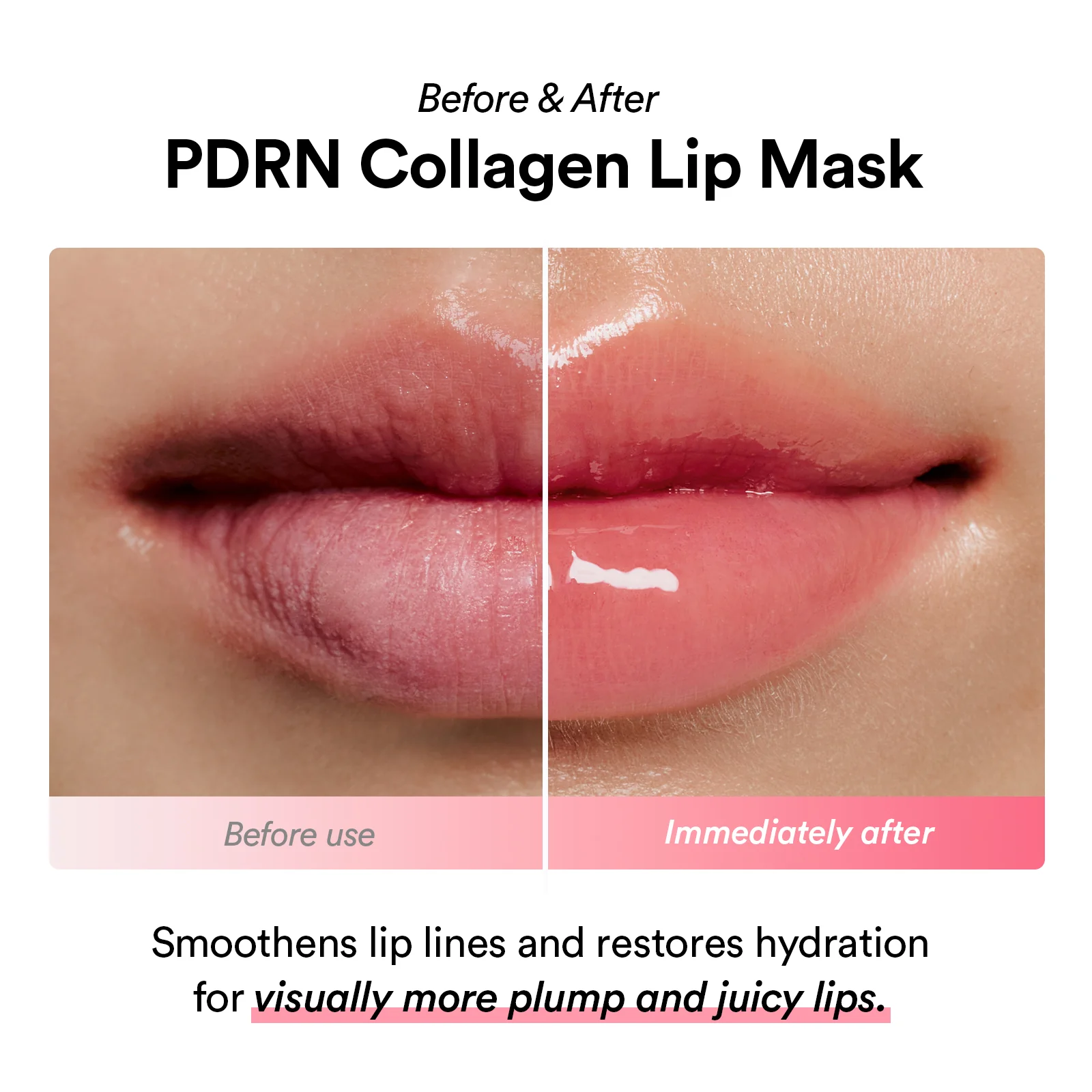 PDRN collagen lip mask Glazed jelly - Image 4