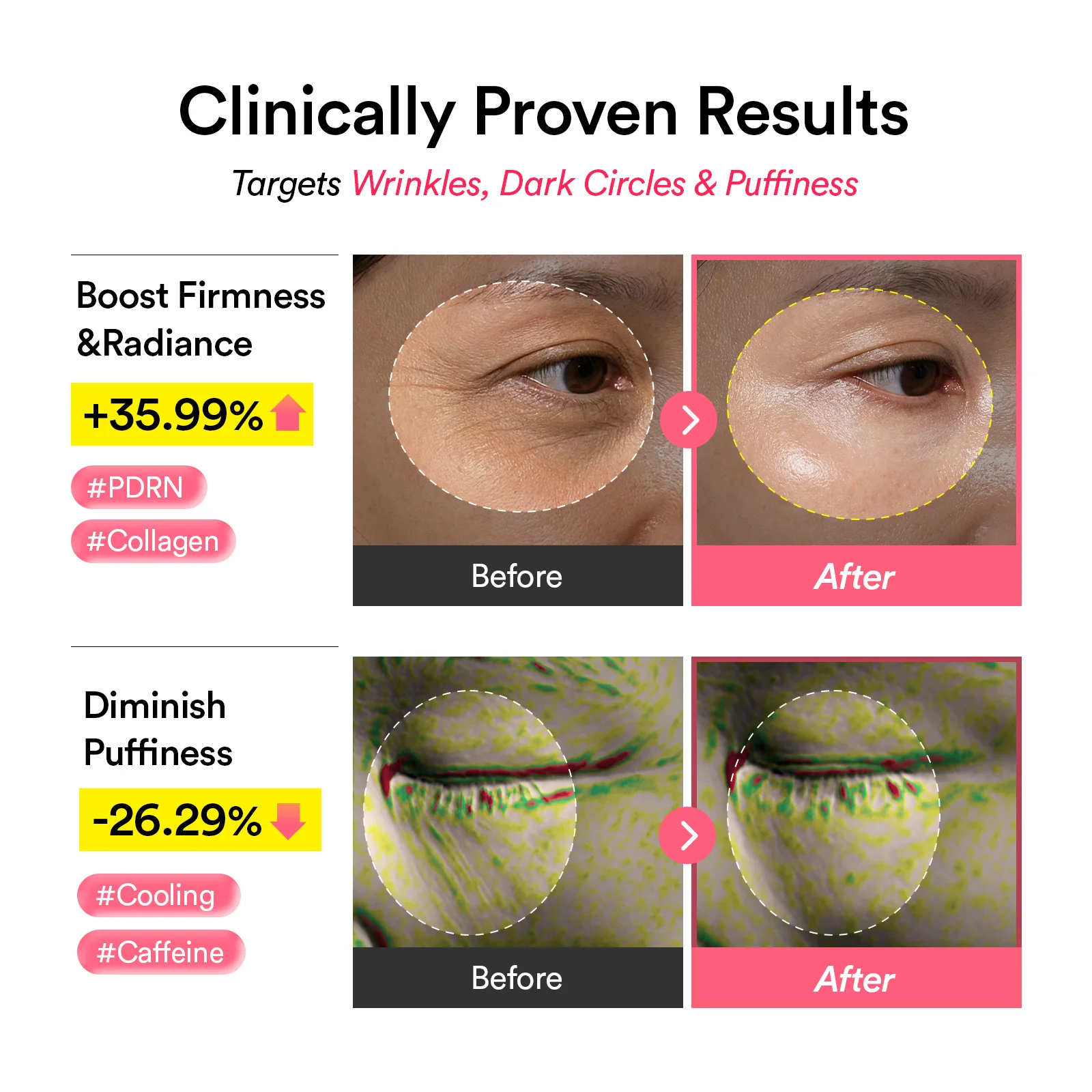 PDRN x Retinal x Collagen Eye Patches for Wrinkle Repair & Anti-Aging Care - Image 3