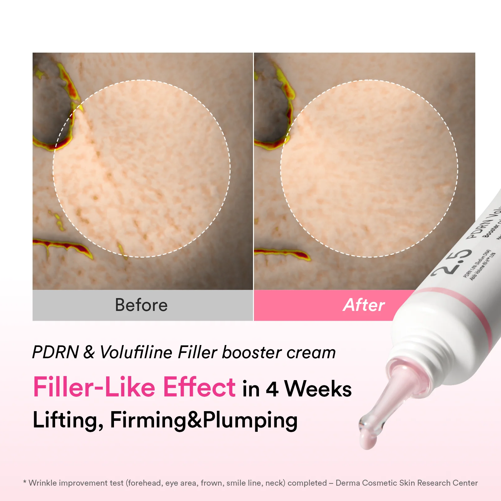 [NEW LAUNCH] Korea’s pharmacy best-seller PDRN & Volufiline wrinkle cream - Image 3