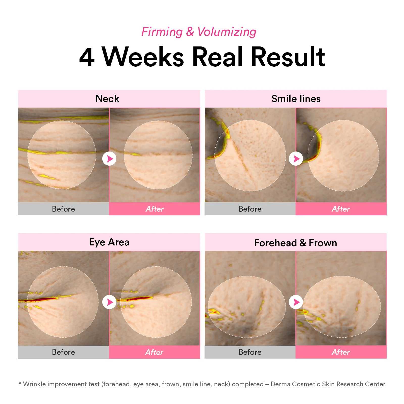 [NEW LAUNCH] Korea’s pharmacy best-seller PDRN & Volufiline wrinkle cream - Image 4